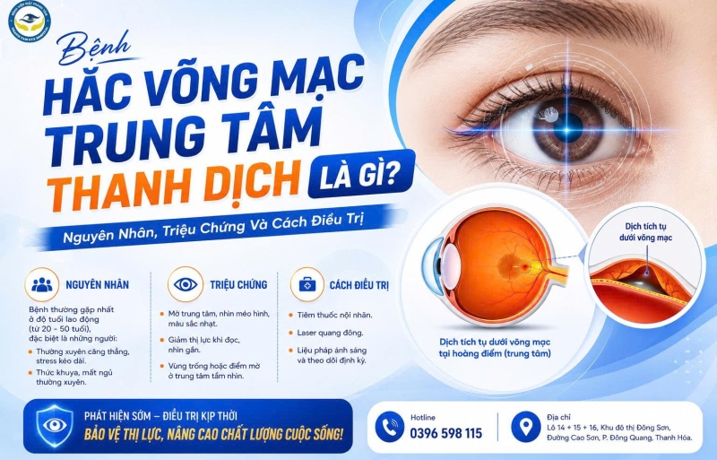 Bệnh Hắc Võng Mạc Trung Tâm Thanh Dịch Là Gì? Nguyên Nhân, Triệu Chứng Và Cách Điều Trị