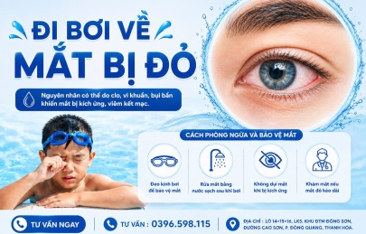 ĐI BƠI VỀ MẮT BỊ ĐỎ: NGUYÊN NHÂN VÀ CÁCH XỬ LÝ CHUẨN Y KHOA BA MẸ CẦN BIẾT