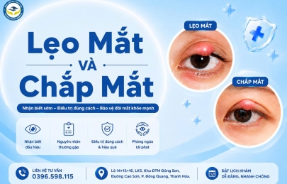 LẸO MẮT VÀ CHẮP MẮT: NGUYÊN NHÂN, DẤU HIỆU VÀ CÁCH ĐIỀU TRỊ AN TOÀN TUYỆT ĐỐI