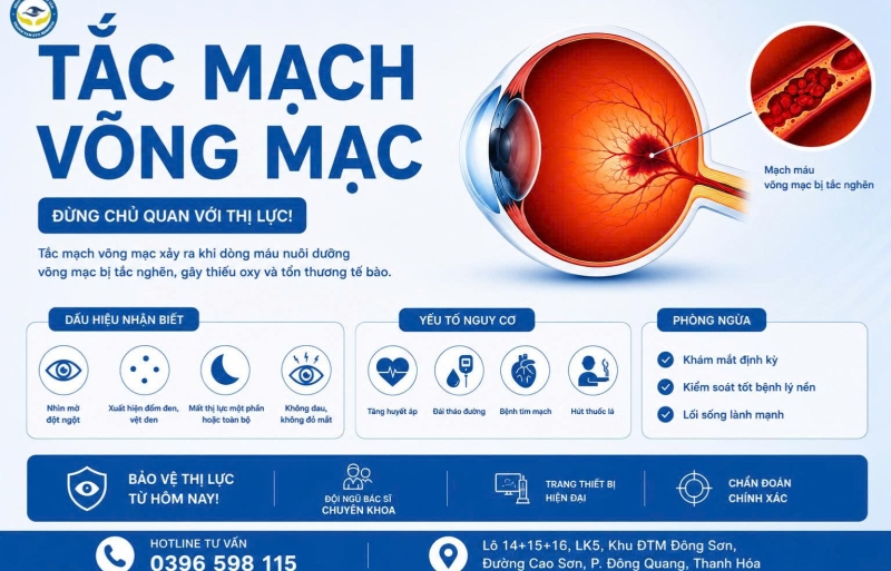 TẮC MẠCH VÕNG MẠC (ĐỘT QUỴ MẮT): NGUYÊN NHÂN, DẤU HIỆU VÀ CẤP CỨU Y KHOA KỊP THỜI